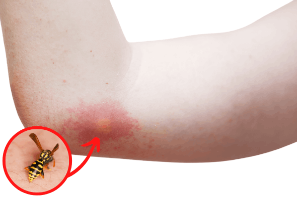 Attention aux Guêpes !